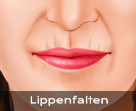 Informationen zu Lippenfalten