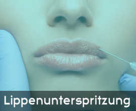 Informationen zu Lippenunterspritzung