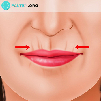 Mundfalten Tipps Gegen Faltige Haut
