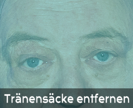 Tränensäcke entfernen